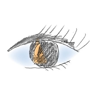MS-News "MS und Augen"